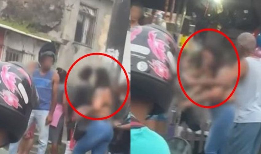  Vítima de ataque com ácido a mando do ex no São Caetano precisou voltar ao HGE